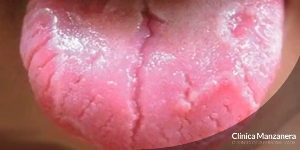 Cómo Quitar el Cuero a la Lengua de Res: Guía Completa para Cocinar Lengua - Qué hacer cuando se pela la lengua como quitar el cuero a la lengua de res - Qué hacer cuando se pela la lengua